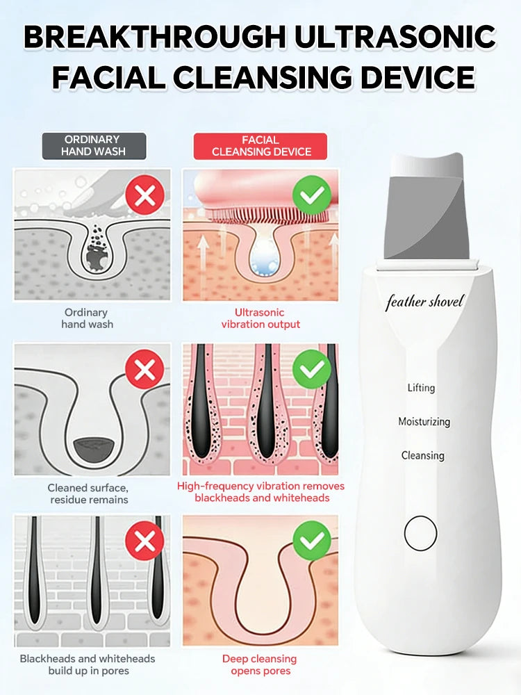 Limpiador Facial Ultrasónico con Iones y Microcorriente EMS – Limpieza Profunda de Poros
