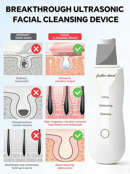 Limpiador Facial Ultrasónico con Iones y Microcorriente EMS – Limpieza Profunda de Poros