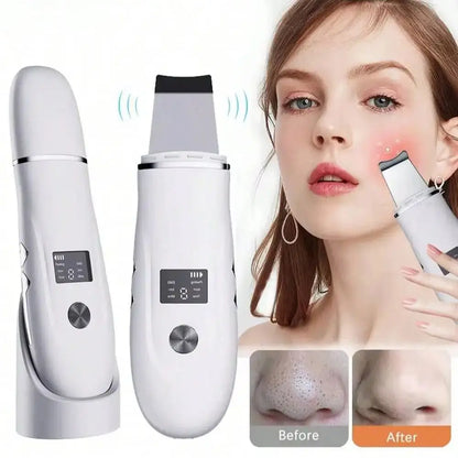 Espátula Facial Ultrasónica Recargable – Peeling, Limpieza Profunda y Eliminación de Puntos Negros