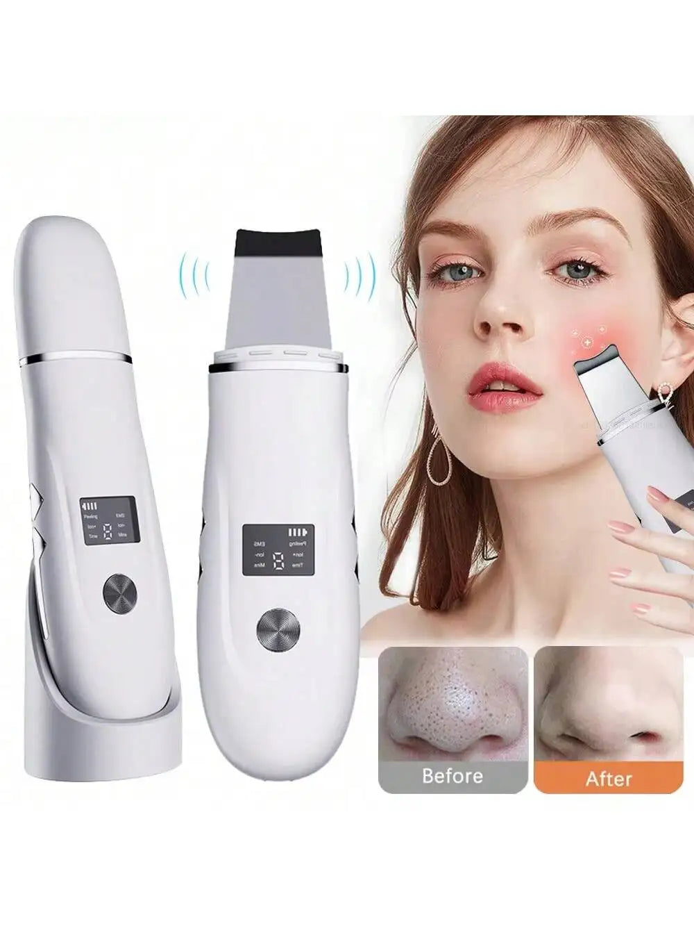 Espátula Facial Ultrasónica Recargable – Peeling, Limpieza Profunda y Eliminación de Puntos Negros