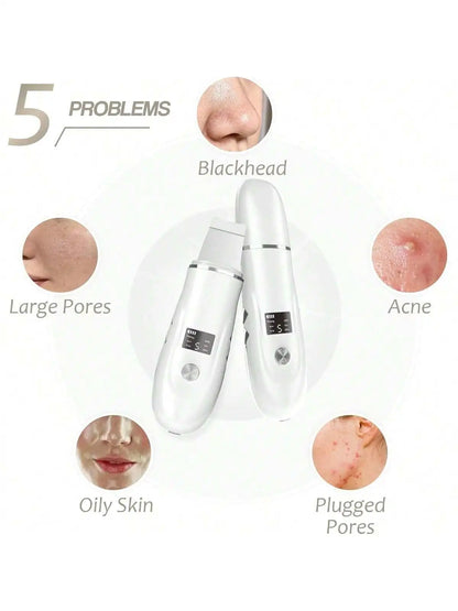 Espátula Facial Ultrasónica Recargable – Peeling, Limpieza Profunda y Eliminación de Puntos Negros