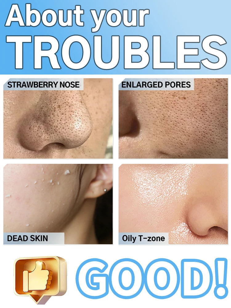 Limpiador Facial Ultrasónico con Iones y Microcorriente EMS – Limpieza Profunda de Poros